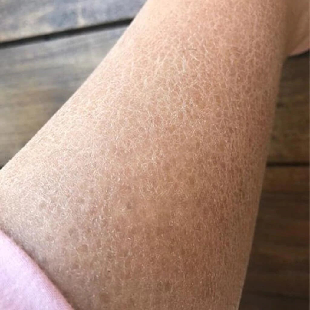 Mini Trahnna Καταπραϋντικό Σώματος με Καρδιόφυλλο Moonseed